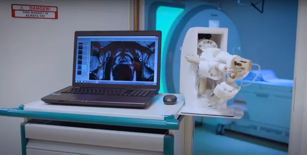 Un système innovant permettant de réaliser des biopsies de prostate directement dans l’IRM plutôt qu’en échographie.