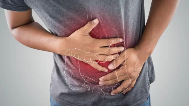 Cancer colorectal